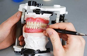 The denture creation process is very intricate and customized to your individual prosthetic