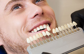 Man's smile compared with tooth color chart