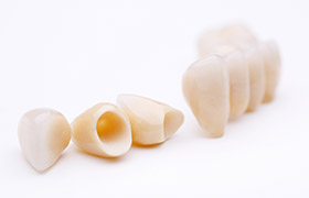 Dental crown and fixed bridge models