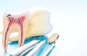 Model tooth and dental tools for root canal therapy in Beverly