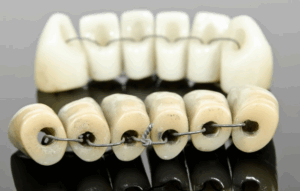 An old set of dentures tied together with a metal wire